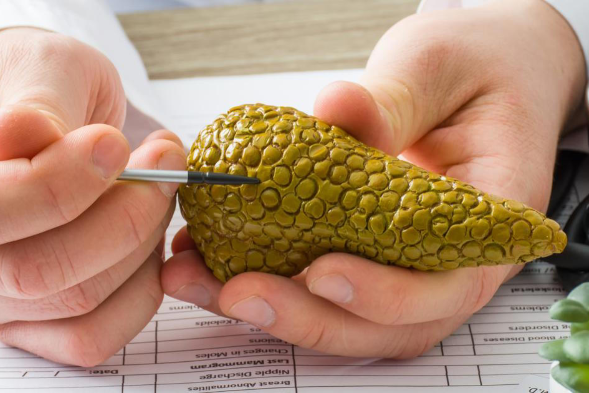 Pancreas Transplant